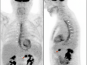 Case 6 (Image 1)