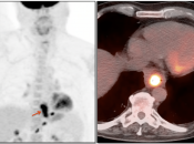 Case 1 (Image 1)