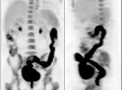 Case 2 (Image 1)