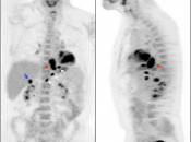 Case 2 (Image 1)