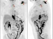 Case 3 (Image 1)