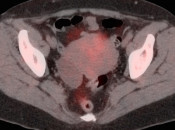 Case 8 (Image 1)