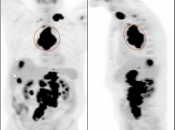 Case 5 (Image 1)