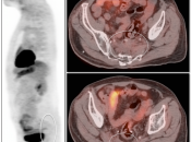 Case 1 (Image 1)