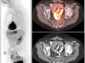 Case 2 (Image 1)