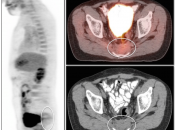 Case 3 (Image 1)