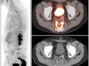 Case 4 (Image 1)