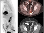 Case 5 (Image 1)