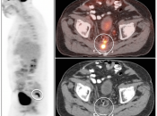 Case 6 (Image 1)