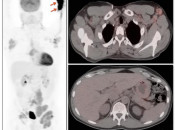 Figure 2 (Image 1) sponge effect