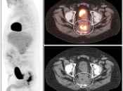 Case 7 (Image 1)