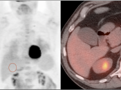 Case 1 (Image 1)