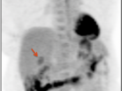 Case 2 (Image 1)