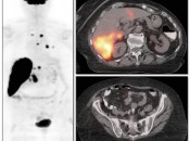 Figure 4 (Image 1) sponge effect