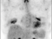 Case 3 (Image 1)