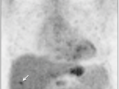 Case 6 (Image 1)