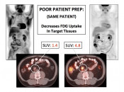 Figure 2 (Image 1) poor patient prep