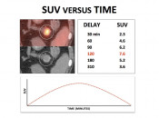 Figure 3 (Image 1) suv versus time