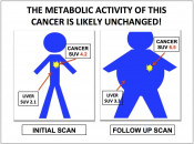 Figure 7 (Image 1) the metabolic activity of this cancer is likely unchanged