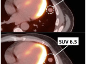 Figure 9 (Image 1) suv