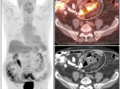 Case 1 (Image 1)