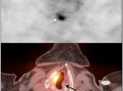 Case 2 (Image 1)