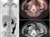 Case 3 (Image 1)