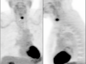 Case 3 (Image 1)