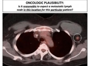 Figure 1 (Image 1) PET/CT Scan