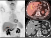 Case 4 (Image 1)