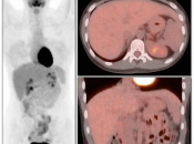 Case 1 (Image 1)