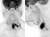 Case 4 (Image 1)
