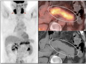 Case 5 (Image 1)