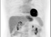 Case 5 (Image 1)