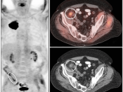 Case 6 (Image 1)