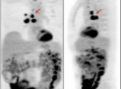 Case 6 (Image 1)