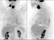 Case 7 (Image 1)