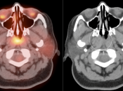 Case 3 (Image 1)