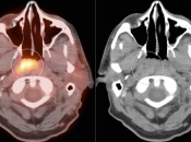 Case 4 (Image 1)