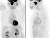 Case 5 (Image 1)