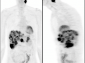 Case 6 (Image 1)