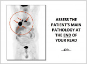 Figure 4 (Image 1) PET/CT Scan