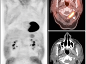 Case 1 (Image 1)