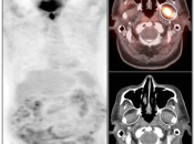Case 3 (Image 1)