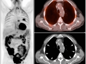 Case 4 (Image 1)