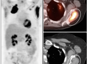 Case 5 (Image 1)