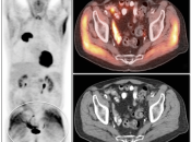 Case 6 (Image 1)
