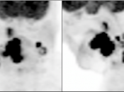 Case 6 (Image 1)