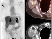 Case 7 (Image 1)