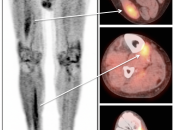 Case 8 (Image 1)